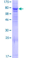 ELP4 Protein - 12.5% SDS-PAGE of human ELP4 stained with Coomassie Blue