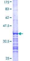 ELP4 Protein - 12.5% SDS-PAGE Stained with Coomassie Blue.