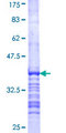 ELP4 Protein - 12.5% SDS-PAGE Stained with Coomassie Blue.