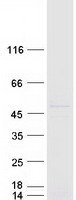 ELP4 Protein - Purified recombinant protein ELP4 was analyzed by SDS-PAGE gel and Coomassie Blue Staining