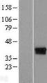 ELP5 Protein - Western validation with an anti-DDK antibody * L: Control HEK293 lysate R: Over-expression lysate