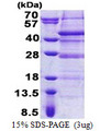 ELP5 Protein