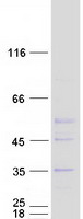ELP6 Protein - Purified recombinant protein ELP6 was analyzed by SDS-PAGE gel and Coomassie Blue Staining