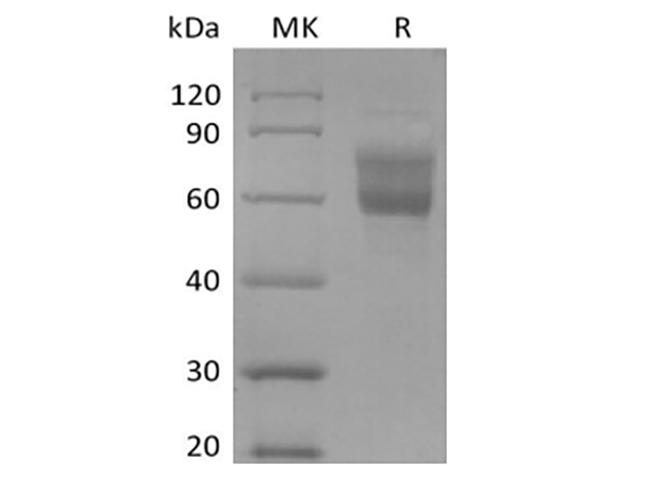 EMA / MUC1 Protein - Recombinant Human Mucin-1/MUC-1 (C-Fc-Avi) Biotinylated