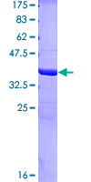 EMA / MUC1 Protein - 12.5% SDS-PAGE Stained with Coomassie Blue