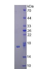 EMA / MUC1 Protein - Recombinant Mucin 1 By SDS-PAGE