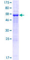 EMB/ Embigin Protein - 12.5% SDS-PAGE of human EMB stained with Coomassie Blue