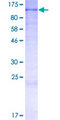 EMC1 Protein - 12.5% SDS-PAGE of human KIAA0090 stained with Coomassie Blue