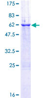 EMC2 / TTC35 Protein - 12.5% SDS-PAGE of human TTC35 stained with Coomassie Blue