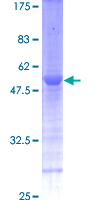 EMC8 / COX4NB Protein - 12.5% SDS-PAGE of human COX4NB stained with Coomassie Blue