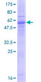 EMD / Emerin Protein - 12.5% SDS-PAGE of human EMD stained with Coomassie Blue