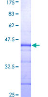 EMD / Emerin Protein - 12.5% SDS-PAGE Stained with Coomassie Blue.