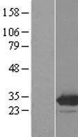 EMG1 / NEP1 Protein - Western validation with an anti-DDK antibody * L: Control HEK293 lysate R: Over-expression lysate