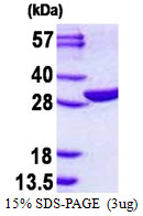 EMG1 / NEP1 Protein