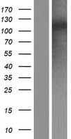 EMI2 / FBXO43 Protein - Western validation with an anti-DDK antibody * L: Control HEK293 lysate R: Over-expression lysate