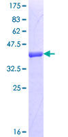 EMI2 / FBXO43 Protein - 12.5% SDS-PAGE Stained with Coomassie Blue.