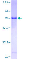 EMILIN1 / EMI Protein - 12.5% SDS-PAGE of human EMILIN1 stained with Coomassie Blue
