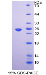 EMILIN1 / EMI Protein - Recombinant Elastin Microfibril Interface Located Protein 1 By SDS-PAGE