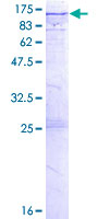 EML1 / EMAP Protein - 12.5% SDS-PAGE of human EML1 stained with Coomassie Blue