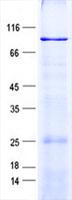 EML1 / EMAP Protein