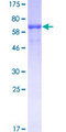 EML2 / EMAP2 Protein - 12.5% SDS-PAGE of human EML2 stained with Coomassie Blue
