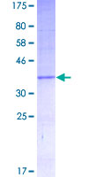 EMP1 Protein - 12.5% SDS-PAGE of human EMP1 stained with Coomassie Blue