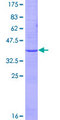 EMP2 Protein - 12.5% SDS-PAGE of human EMP2 stained with Coomassie Blue