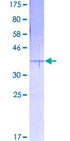 EMP3 Protein - 12.5% SDS-PAGE of human EMP3 stained with Coomassie Blue