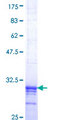 EMP3 Protein - 12.5% SDS-PAGE Stained with Coomassie Blue.