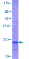 EMP3 Protein - 12.5% SDS-PAGE Stained with Coomassie Blue.