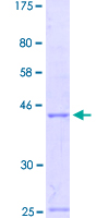 EN2 Protein - 12.5% SDS-PAGE Stained with Coomassie Blue.