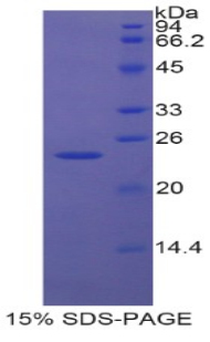 EN2 Protein - Recombinant Engrailed Homeobox Protein 2 (EN2) by SDS-PAGE