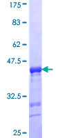 ENAM Protein - 12.5% SDS-PAGE Stained with Coomassie Blue.