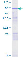 ENC1 Protein - 12.5% SDS-PAGE of human ENC1 stained with Coomassie Blue