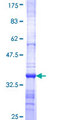 ENC1 Protein - 12.5% SDS-PAGE Stained with Coomassie Blue.