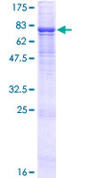 ENDOD1 Protein - 12.5% SDS-PAGE of human ENDOD1 stained with Coomassie Blue