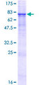 ENDOD1 Protein - 12.5% SDS-PAGE of human ENDOD1 stained with Coomassie Blue