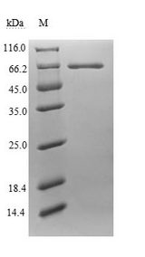 Endogenous Retrovirus HERV-K10 putative protease Protein - (Tris-Glycine gel) Discontinuous SDS-PAGE (reduced) with 5% enrichment gel and 15% separation gel.