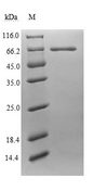 Endogenous Retrovirus HERV-K10 putative protease Protein - (Tris-Glycine gel) Discontinuous SDS-PAGE (reduced) with 5% enrichment gel and 15% separation gel.