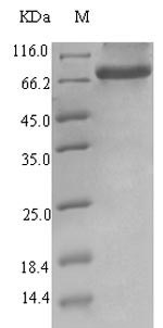 Endogenous Retrovirus HERV-K10 putative protease Protein - (Tris-Glycine gel) Discontinuous SDS-PAGE (reduced) with 5% enrichment gel and 15% separation gel.