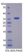 Endonuclease G / ENDOG Protein - Recombinant Endonuclease G, Mitochondrial By SDS-PAGE