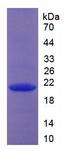 Endostatin Protein - Recombinant Collagen Type XVIII By SDS-PAGE