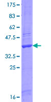 ENDOU Protein - 12.5% SDS-PAGE Stained with Coomassie Blue