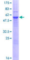 ENDOV Protein - 12.5% SDS-PAGE of human FLJ35220 stained with Coomassie Blue