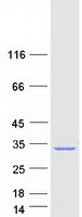 ENDOV Protein - Purified recombinant protein ENDOV was analyzed by SDS-PAGE gel and Coomassie Blue Staining