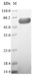 ENGASE Protein - (Tris-Glycine gel) Discontinuous SDS-PAGE (reduced) with 5% enrichment gel and 15% separation gel.