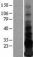 ENHO / Adropin Protein - Western validation with an anti-DDK antibody * L: Control HEK293 lysate R: Over-expression lysate