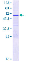 ENKUR Protein - 12.5% SDS-PAGE of human C10orf63 stained with Coomassie Blue