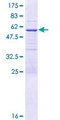 ENKUR Protein - 12.5% SDS-PAGE of human C10orf63 stained with Coomassie Blue