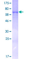 ENO1 / Alpha Enolase Protein - 12.5% SDS-PAGE of human ENO1 stained with Coomassie Blue